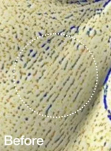 Steps For Even Skin Texture 01 Apply to hands or a cotton pad. 02 Gently layer onto the face and neck. 03 May be used on affected areas of the body. 04 Apply once every 2~3 days and observe the skin’s response. Adjust the usage frequency accordingly. 05 When used in the morning, use with SPF 30 or higher.