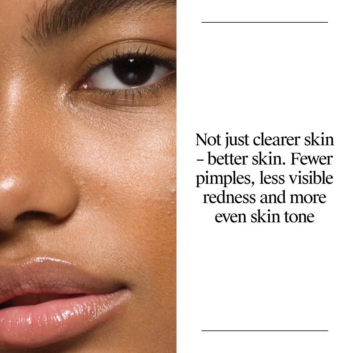 Neutrogena® Oil Free Acne Wash 16 Fl Oz - Image 4