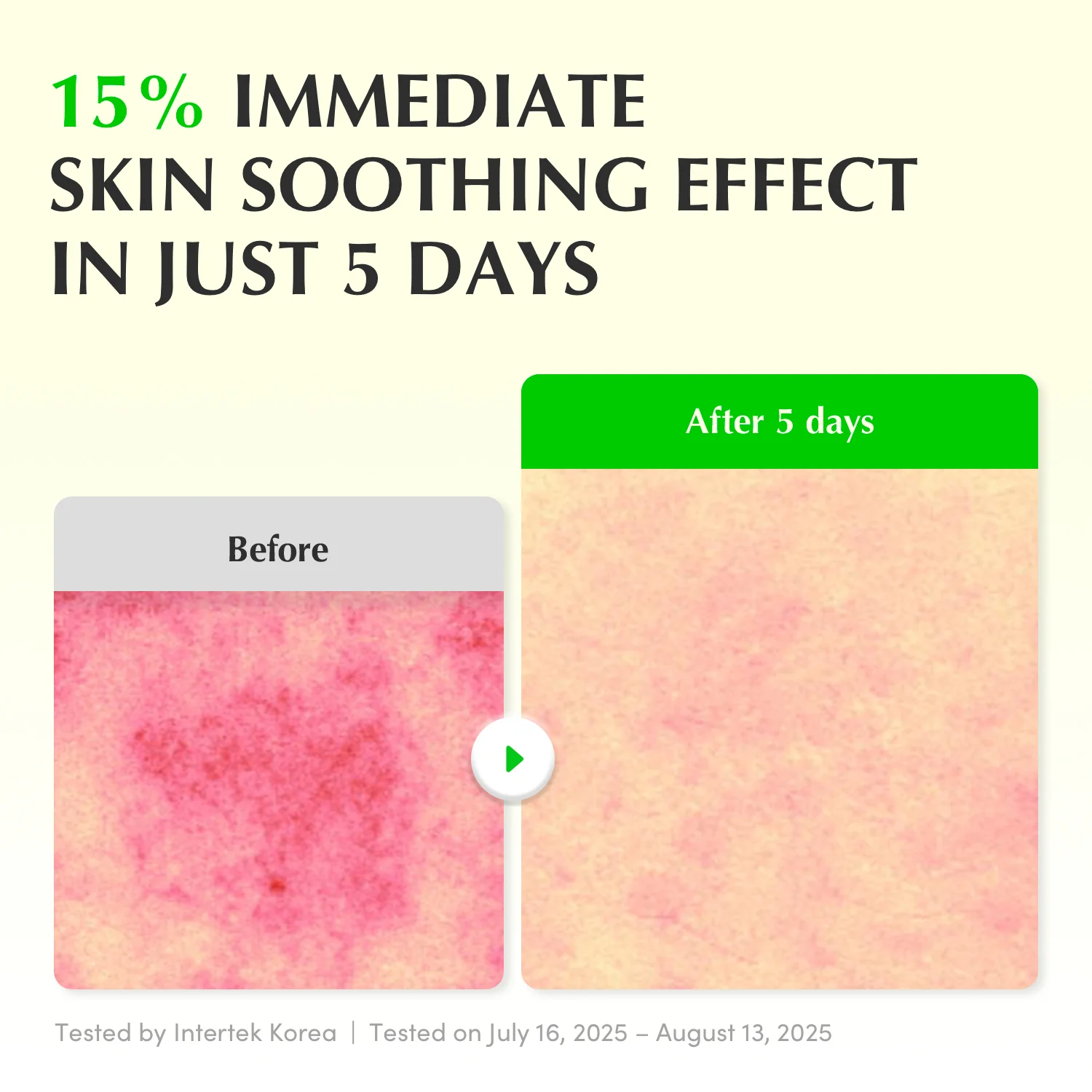 Equal berry Aloe PDRN Calming Serum - Image 4